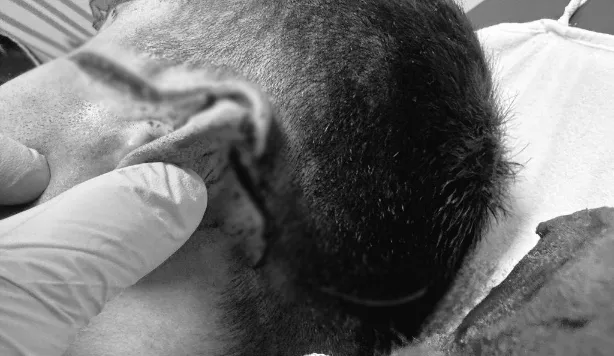 Cezaevinde Memura Saldırı: İnfaz Koruma Memurunun Yüzü Tanınmaz Halde